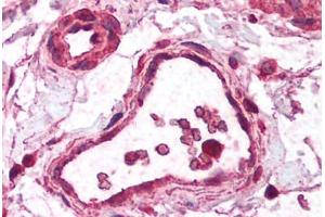 Human Small Intestine, Vessel (formalin-fixed, paraffin-embedded) stained with ZBTB33 antibody ABIN213733 at 2. (ZBTB33 antibody  (N-Term))