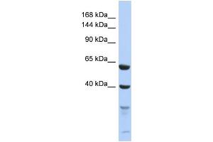 Western Blotting (WB) image for anti-Testis Expressed 11 (TEX11) (C-Term) antibody (ABIN2506525) (TEX11 antibody  (C-Term))