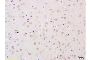 Immunohistochemistry (Paraffin-embedded Sections) (IHC (p)) image for anti-Hydroxysteroid (11-Beta) Dehydrogenase 2 (HSD11B2) (AA 151-250) antibody (ABIN701680)