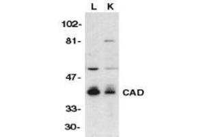 Western blot analysis of CAD in mouse lung (L) and kidney (K) tissue lysates with AP30175PU-N CAD antibody at 1/500 dilution. (DFFB antibody  (C-Term))