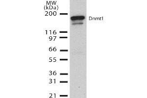 Western Blot analysis of Human H1299 cell lysate showing detection of DNMT1 protein using Mouse Anti-DNMT1 Monoclonal Antibody, Clone 60B1220. (DNMT1 antibody  (AA 637-650) (PE))