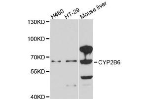 Western blot analysis of extracts of various cell lines, using CYP2B6 antibody. (CYP2B6 antibody)