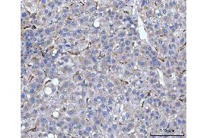 IHC analysis of Hsp47/SERPINH1 using anti-Hsp47/SERPINH1 antibody (ABIN3043331). (SERPINH1 antibody  (AA 247-418))