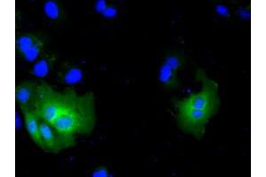 Image no. 9 for anti-Acetyl-CoA Acetyltransferase 2 (ACAT2) antibody (ABIN1496402) (ACAT2 antibody)