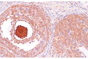 Immunohistochemistry of paraffin-embedded Rat ovary using CDC20 Polyclonal Antibody at dilution of 1:100 (40x lens).
