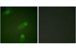 Immunofluorescence (IF) image for anti-Nuclear Factor of kappa Light Polypeptide Gene Enhancer in B-Cells 1 (NFKB1) (AA 896-945) antibody (ABIN2888573) (NFKB1 antibody  (AA 896-945))