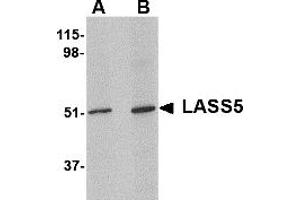 Western Blotting (WB) image for anti-LAG1 Homolog, Ceramide Synthase 5 (LASS5) (N-Term) antibody (ABIN1031694) (LASS5 antibody  (N-Term))