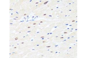 Immunohistochemistry of paraffin-embedded Rat heart using BRMS1 Polyclonal Antibody at dilution of 1:100 (40x lens). (BRMS1 antibody)