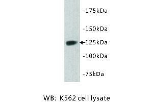 Image no. 1 for anti-tyrosine Kinase with Immunoglobulin-Like and EGF-Like Domains 1 (TIE1) antibody (ABIN1112934)