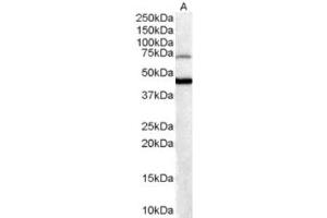 Western Blotting (WB) image for anti-Forkhead Box G1 (FOXG1) (C-Term) antibody (ABIN2465212) (FOXG1 antibody  (C-Term))