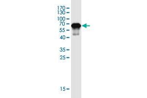 Western Blot detection against Immunogen (46. (ZNF428 antibody  (AA 1-188))