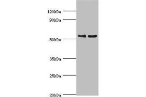 Western blot All lanes: Transcription factor EB antibody at 3 μg/mL Lane 1: Jurkat whole cell lysate Lane 2: Mouse brain tissue Secondary Goat polyclonal to rabbit IgG at 1/10000 dilution Predicted band size: 53, 44 kDa Observed band size: 53 kDa (TFEB antibody  (AA 1-220))