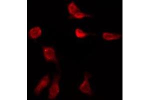 ABIN6276014 staining HeLa by IF/ICC. (GPR149 antibody  (Internal Region))