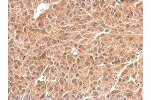 Immunohistochemistry (IHC) image for anti-phosphorylase, Glycogen, Brain (GPBB) (C-Term) antibody (ABIN2855804)