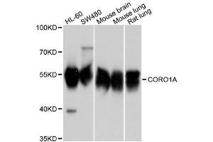 Western blot analysis of extracts of various cell lines, using CORO1A antibody. (Coronin 1a antibody  (AA 362-461))