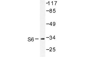 Image no. 1 for anti-Ribosomal Protein S6 (RPS6) antibody (ABIN272077) (RPS6 antibody)