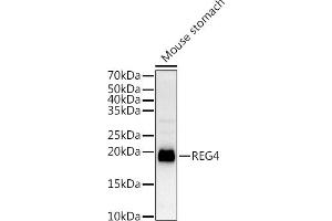 Western blot analysis of extracts of Mouse stomach, using REG4 antibody (ABIN6132619, ABIN6146859, ABIN6146860 and ABIN6217007) at 1:1000 dilution. (REG4 antibody  (AA 23-158))