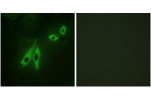 Immunofluorescence analysis of NIH-3T3 cells, using AKAP3 Antibody.