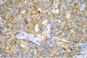 anti-Non-Metastatic Cells 1, Protein (NM23A) Expressed in (NME1) antibody