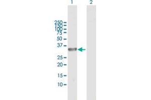 Western Blot analysis of DCUN1D3 expression in transfected 293T cell line by DCUN1D3 MaxPab polyclonal antibody. (DCUN1D3 antibody  (AA 1-304))