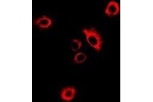 Immunofluorescent analysis of GlyRS staining in MCF7 cells. (GlyRS antibody)