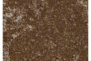 ABIN6261807 and ABIN6277494 at 1/100 staining Mouse spleen tissue by IHC-P. (FOXP1 antibody  (C-Term))
