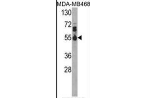 Western blot analysis of IL17RB Antibody (Center) in MDA-MB468 cell line lysates (35ug/lane). (IL17 Receptor B antibody  (Middle Region))