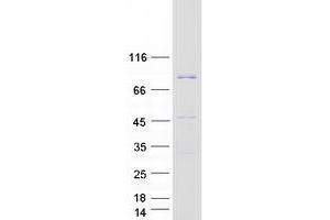 Eukaryotic Translation Elongation Factor 1 delta (Guanine Nucleotide Exchange Protein) (EEF1D) (Transcript Variant 5) protein (Myc-DYKDDDDK Tag)