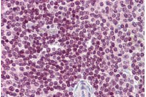 Human Spleen: Formalin-Fixed, Paraffin-Embedded (FFPE) (CDC20 antibody  (N-Term))