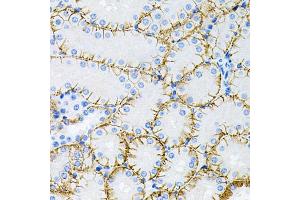 Immunohistochemistry of paraffin-embedded mouse kidney using MAPT antibody (ABIN5970456) at dilution of 1/100 (40x lens). (MAPT antibody)