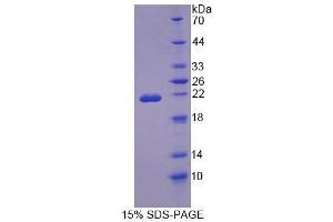 SDS-PAGE (SDS) image for Osteopetrosis Associated Transmembrane Protein 1 (OSTM1) (AA 124-277) protein (His tag) (ABIN4989468)