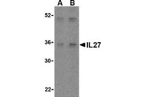 Western blot analysis of IL-27 in Daudi lysate with AP30421PU-N IL-27 antibody at (A) 2 and (B) 4 μg/ml. (IL27 antibody  (Center))