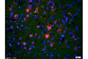 Formalin-fixed and paraffin embedded rat brain labeled with Rabbit Anti CDC40 Polyclonal Antibody, Unconjugated used at 1:200 dilution for 40 minutes at 37°C. (CDC40 antibody  (AA 481-579))