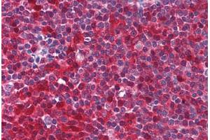 Human Tonsil (formalin-fixed, paraffin-embedded) stained with PYCARD antibody ABIN213971 at 5 ug/ml followed by biotinylated goat anti-rabbit IgG secondary antibody ABIN481713, alkaline phosphatase-streptavidin and chromogen. (PYCARD antibody  (AA 182-195))