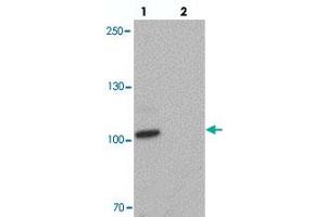 Western blot analysis of CCNT1 in rat brain tissue with CCNT1 polyclonal antibody  at 1 ug/mL in (lane 1) the absence and (lane 2) the presence of blocking peptide.