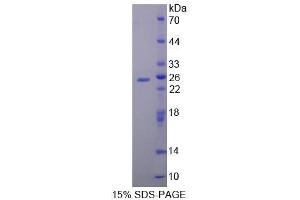 SDS-PAGE (SDS) image for Peroxiredoxin 4 (PRDX4) (AA 14-258) protein (His tag) (ABIN1878251) (Peroxiredoxin 4 Protein (PRDX4) (AA 14-258) (His tag))