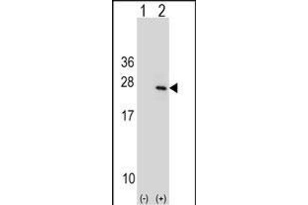 PTP4A1 antibody  (C-Term)