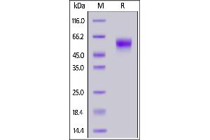 Human IL-2 R gamma, His Tag on  under reducing (R) condition. (IL2RG Protein (AA 23-254) (His tag))