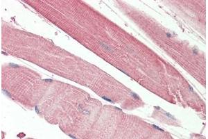 Human Skeletal Muscle: Formalin-Fixed, Paraffin-Embedded (FFPE) (THNSL2 antibody  (AA 192-204))