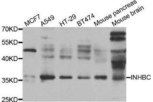 Western blot analysis of extracts of various cell lines, using INHBC antibody. (INHBC antibody)
