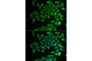 Immunofluorescence analysis of MCF-7 cell using RBP2 antibody. (RBP2 antibody)