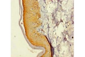 Immunohistochemistry of paraffin-embedded human skin tissue using ABIN7150320 at dilution of 1:100