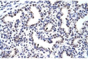 Rabbit Anti-WNT2B Antibody Catalog Number: ARP41254 Paraffin Embedded Tissue: Human Lung Cellular Data: Alveolar cells Antibody Concentration: 4. (WNT2B antibody  (Middle Region))