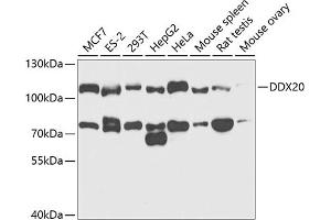 Western blot analysis of extracts of various cell lines, using DDX20 antibody (ABIN6130250, ABIN6139482, ABIN6139483 and ABIN6221507) at 1:1000 dilution. (DDX20 antibody  (AA 25-280))