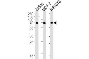 Western Blotting (WB) image for anti-Ribosomal Protein S6 Kinase, 70kDa, Polypeptide 2 (RPS6KB2) antibody (ABIN2995324)