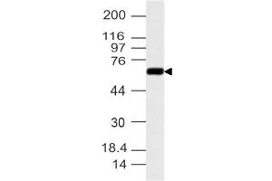 Image no. 1 for anti-Cytochrome P450, Family 1, Subfamily B, Polypeptide 1 (CYP1B1) (AA 1-260) antibody (ABIN5027128)