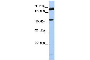 WB Suggested Anti-SMYD3 Antibody Titration:  0.