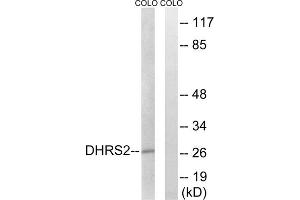 Western blot analysis of extracts from COLO cells, using DHRS2 antibody. (DHRS2 antibody  (Internal Region))