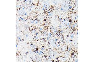 Immunohistochemistry of paraffin-embedded mouse brain using GFAP Rabbit mAb (ABIN7267389) at dilution of 1:100 (40x lens). (GFAP antibody)