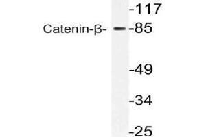 Western blot (WB) analysis of Catenin-beta antibody in extracts from 293 cells. (CTNNB1 antibody)